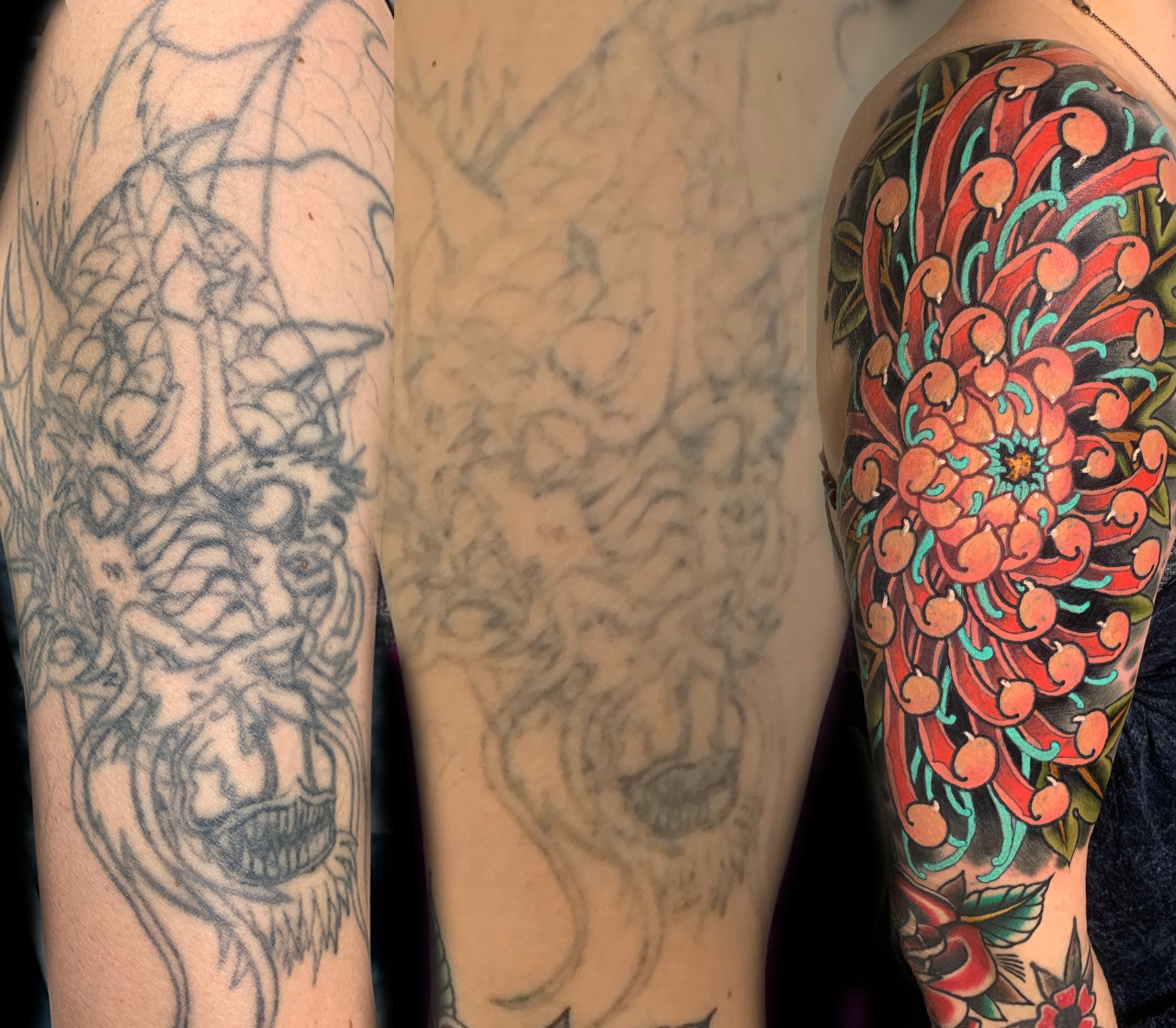 Sun Damage and Tattoos | UV Rays Damage Tattoo Ink