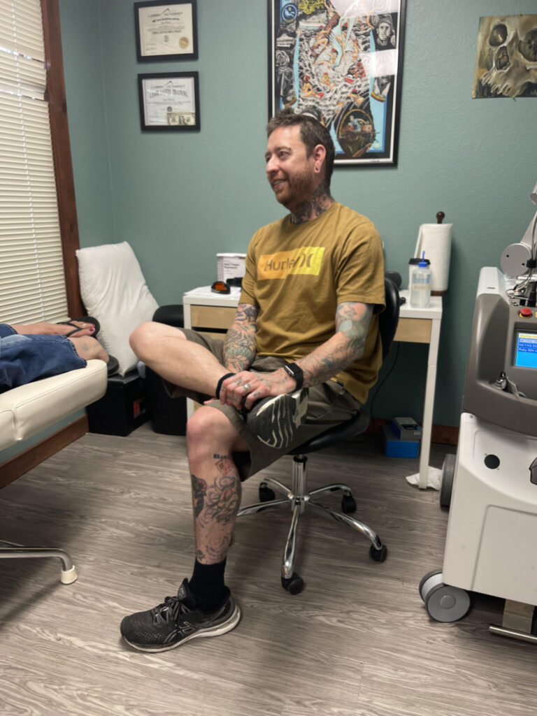 Laser tattoo removal specialist Colorado, tattoo removal preparation