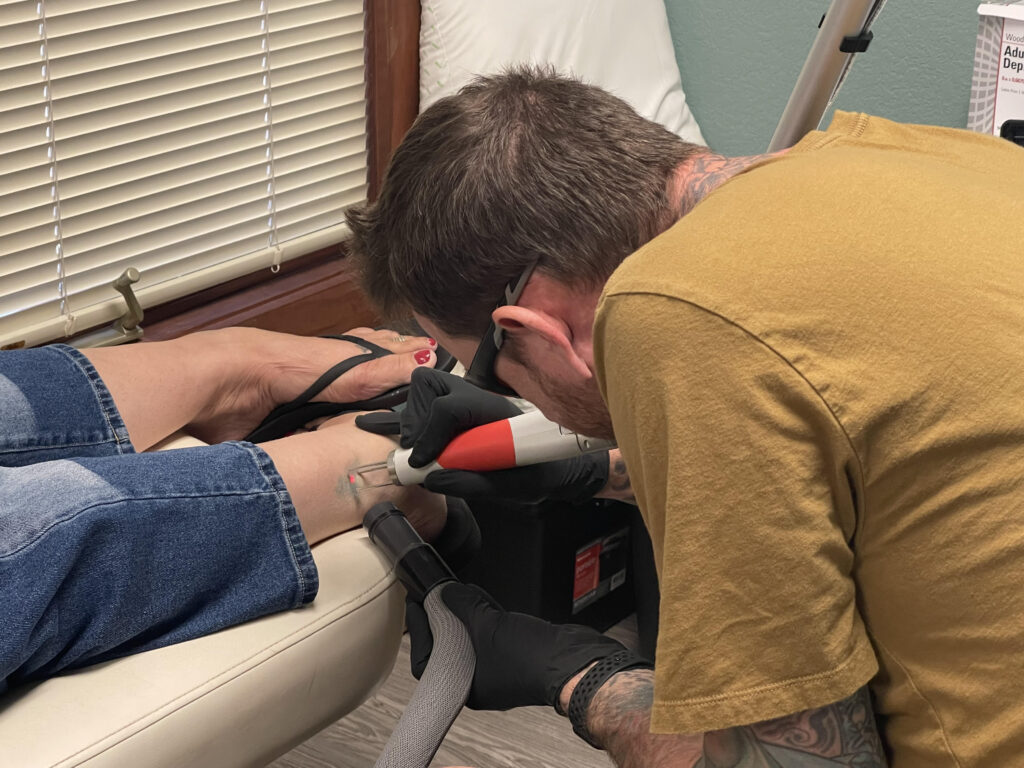 does tattoo removal hurt?
What tattoo removal feels like