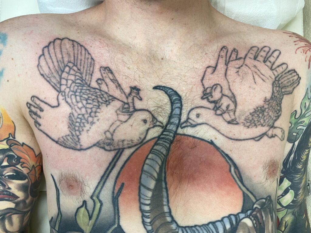 Milo Afring, tattoo coverup, after 1 laser treatment.