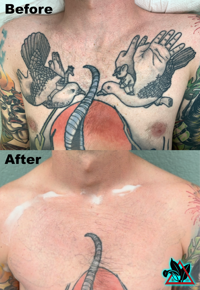 Milo Before After