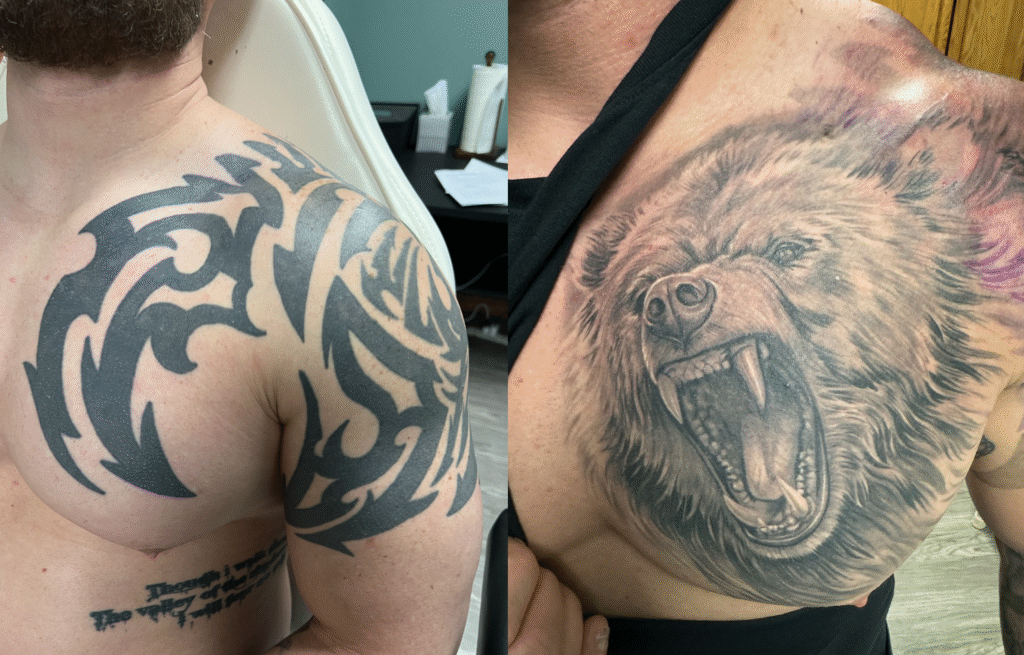 tattoo fading for cover-up compared to full removal diagram
laser tattoo removal sessions